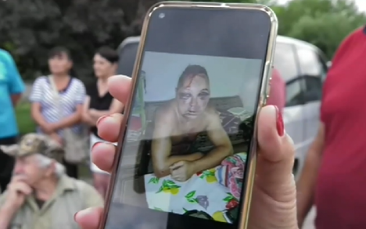 Жена е участвала в побоя на жител на Сливовик